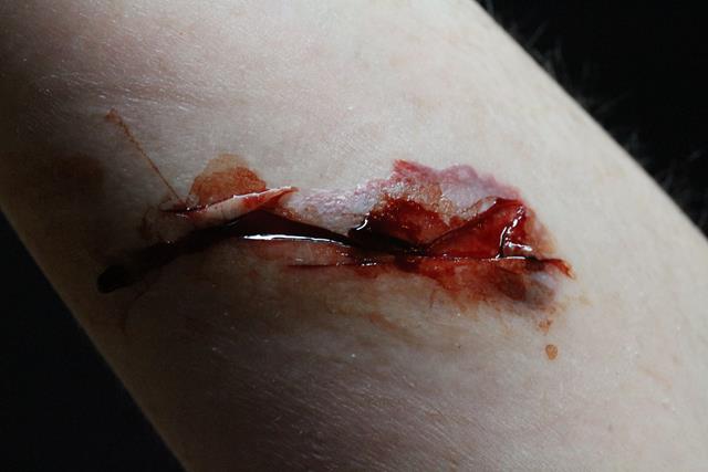 Photo Blank as laceration_640x427