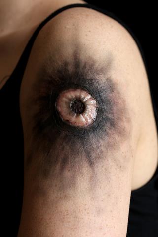 Photo Laser Wound #1 (4)_320x480