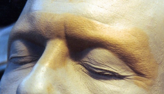 Forehead sculpt
